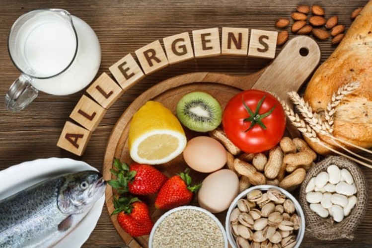 More effective policies to prevent allergen cross contamination are needed in Australia’s food industry, while voluntary labelling needs to more accurately reflect the risk profile, said a HealthNuts project lead investigator. ?Getty Images